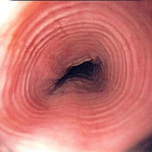 Oesophagus-300x300.jpg