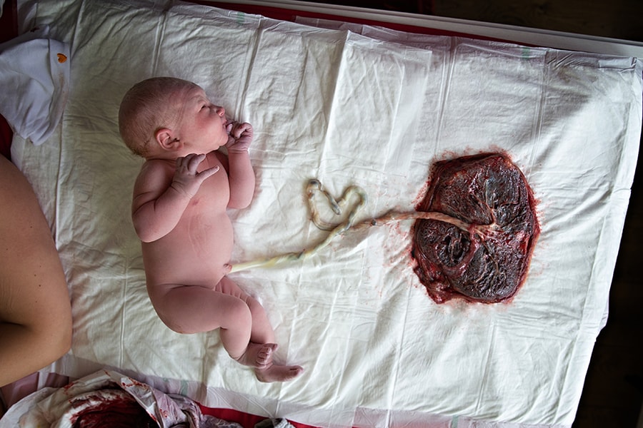 21671ccb-placenta-met-baby.jpg