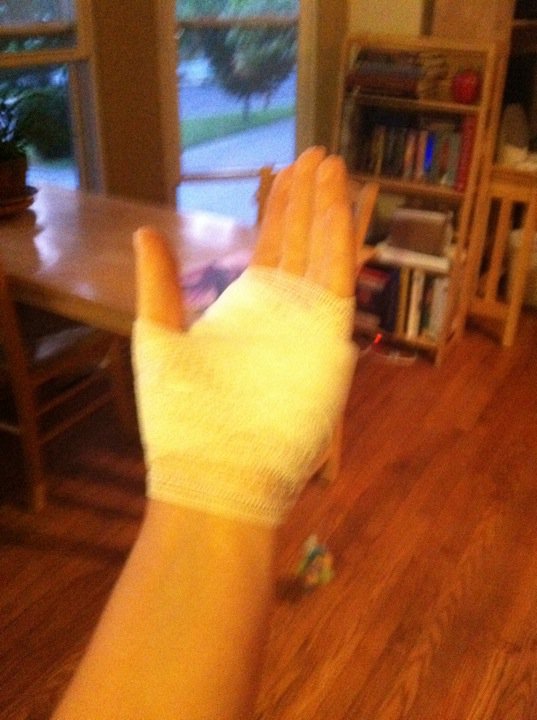 Wounded%2BHand.jpg