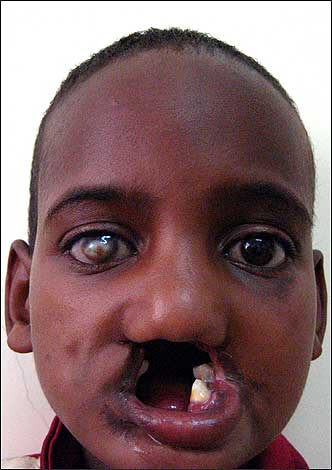 youngster470_332x470.jpg