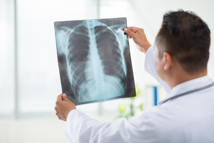 xray.jpg