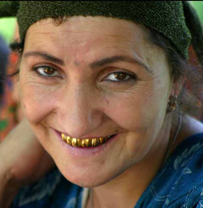 gold-teeth.jpg