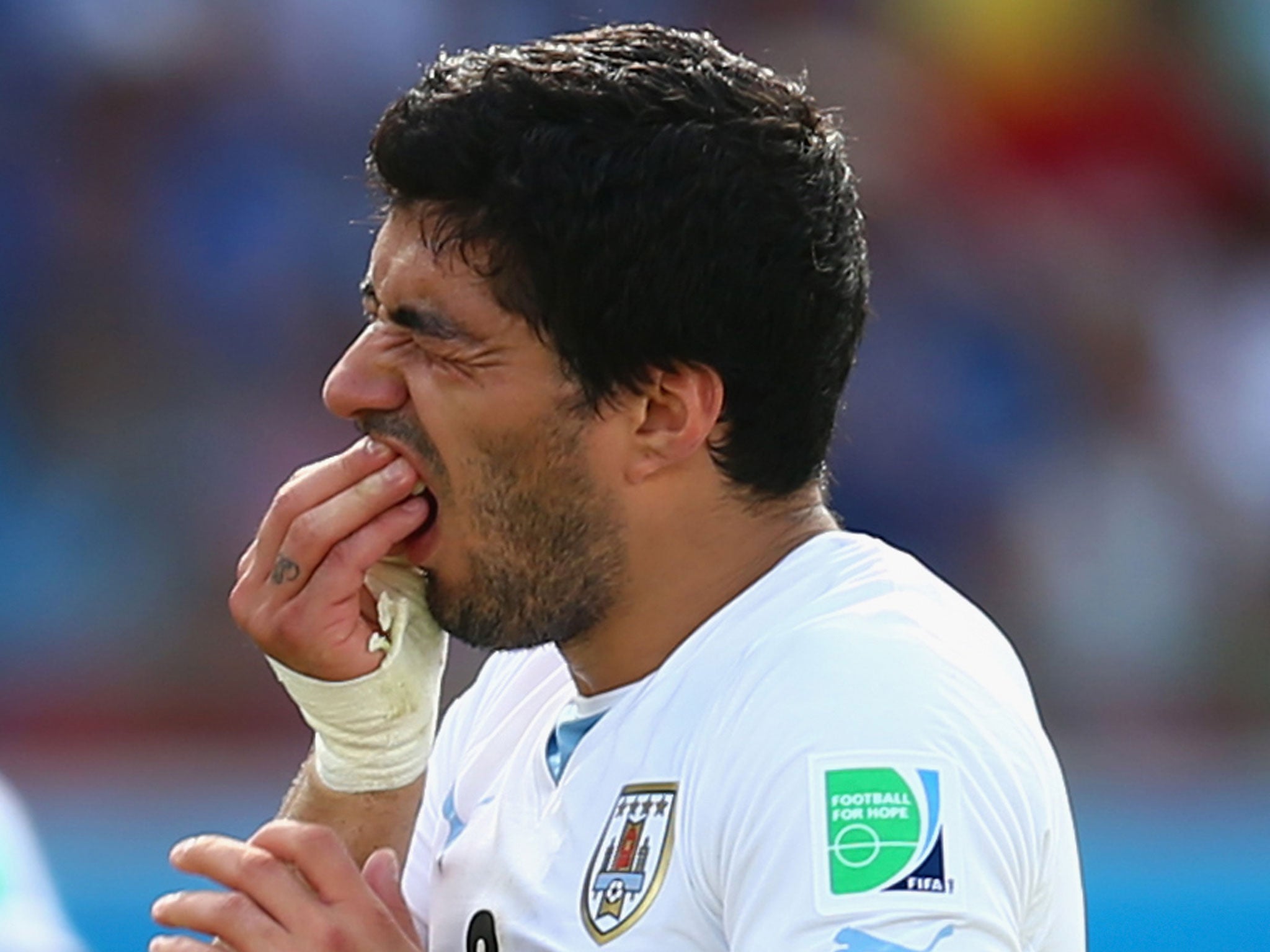 Suarez-teeth.jpg