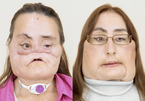 03-15-36_before-and-after_original.jpg
