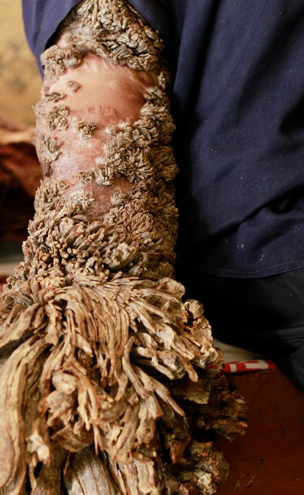 Tree-Man-dies.jpg